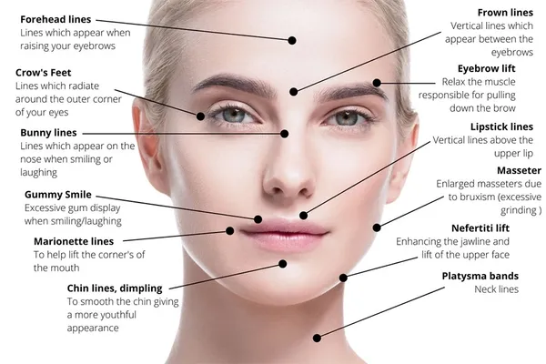 Anti Wrinkle Injections Gold Coast | Anti Wrinkle Injections Price